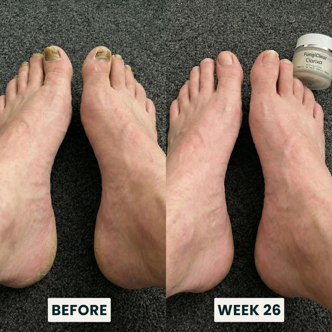 Clarixa - FungiClear