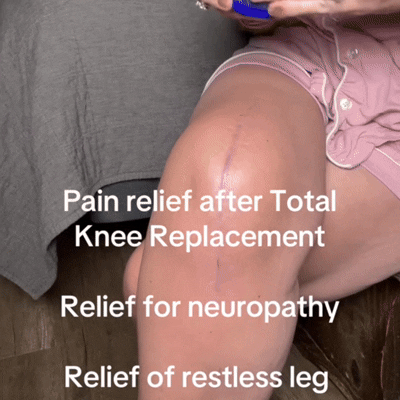 Clarixa Neuropathy Cream